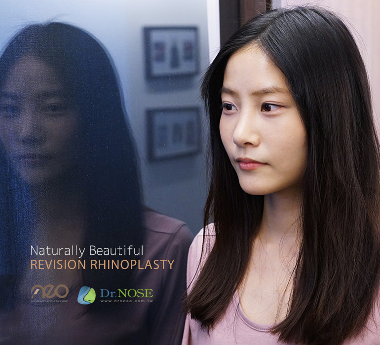 皮膚越來越薄，取出矽膠重修隆鼻