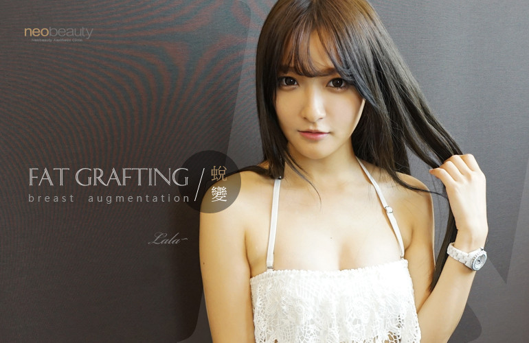 自體脂肪移植豐胸